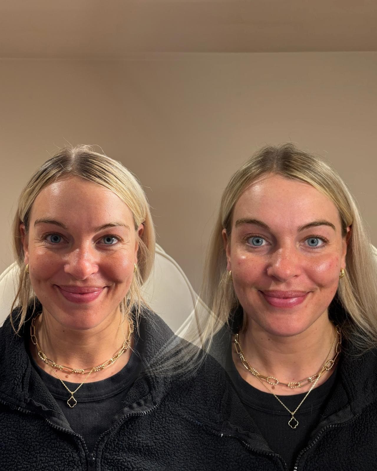Before and after client treatment comparison, shared with consent